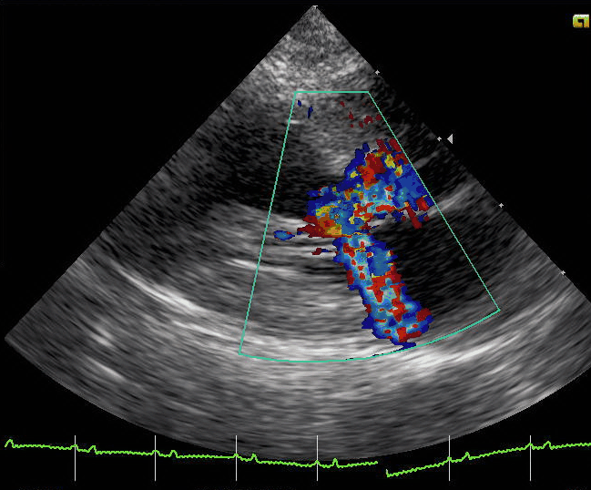 Hypertrophic Cardiomyopathy (Feline) Mar Vista Animal Medical Center